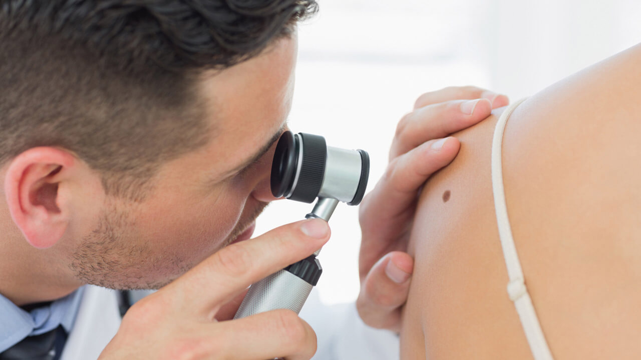Doctor inspecting mole