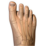 Normal foot without bunion